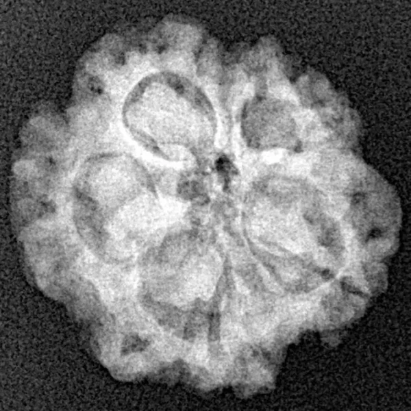 1MK(Underdeveloped) 20.5mm 3.06gm - Xray