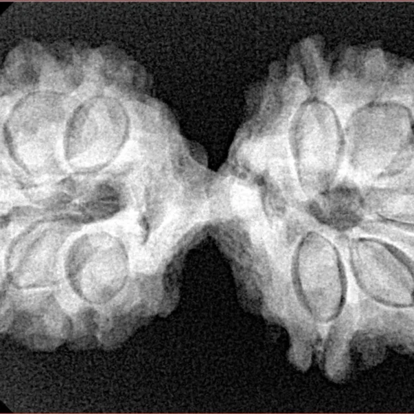 11 MK Gaurishankar 35.1mm 5.9gm - Xray