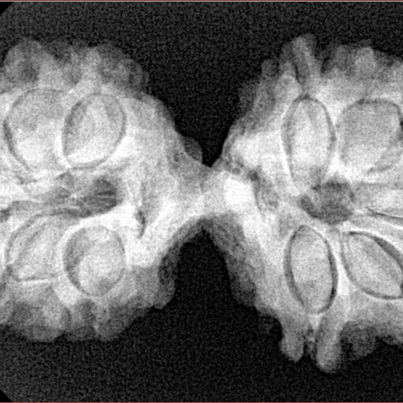 11 MK Gaurishankar 35.1mm 5.9gm - Xray