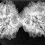 10 Mk Gaurishankar 39mm 8gm - Xray