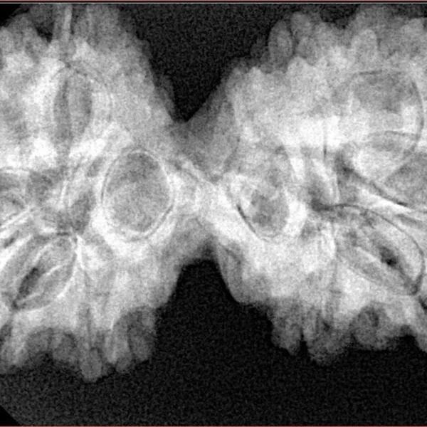 10 Mk Gaurishankar 39mm 8gm - Xray