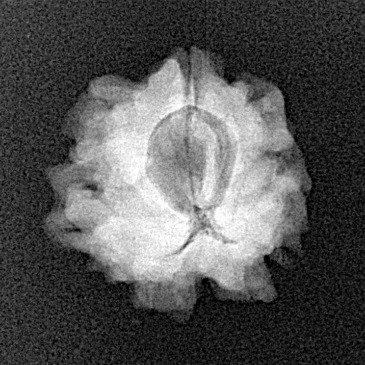 1 Mukhi Rudraksha 20mm 2.31gm - Xray
