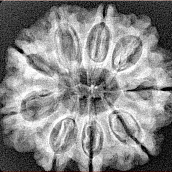 9 Mukhi Rudraksha 27.2mm 5gm - Xray