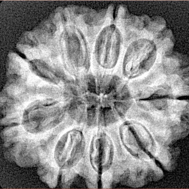 9 Mukhi Rudraksha 27.2mm 5gm - Xray