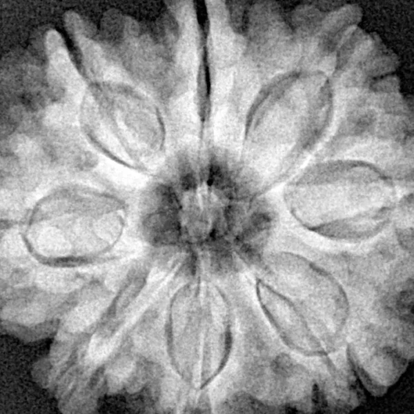 8 Mukhi Rudraksha 28.7mm 6.7gm - Xray