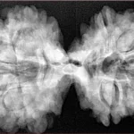 10 Mk Gaurishankar 39.7mm 8.71gm - Xray