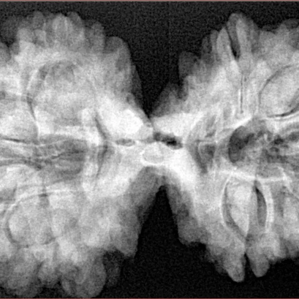 10 Mk Gaurishankar 39.7mm 8.71gm - Xray