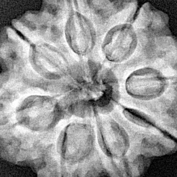 8 Mukhi Rudraksha 28.2mm 7.08gm - Xray