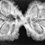 11 MK Gaurishankar 40.6mm 9.22gm - Xray