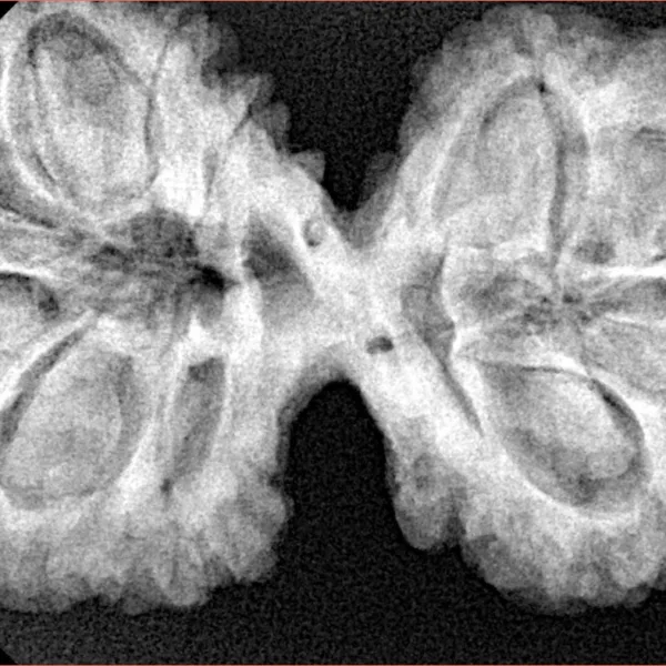 11 MK Gaurishankar 40.6mm 9.22gm - Xray
