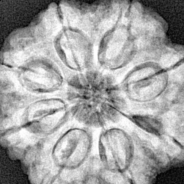 8 Mukhi Rudraksha 26.8mm 6.63gm - Xray