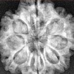8 Mukhi Rudraksha 25.8mm 5.23gm - Xray