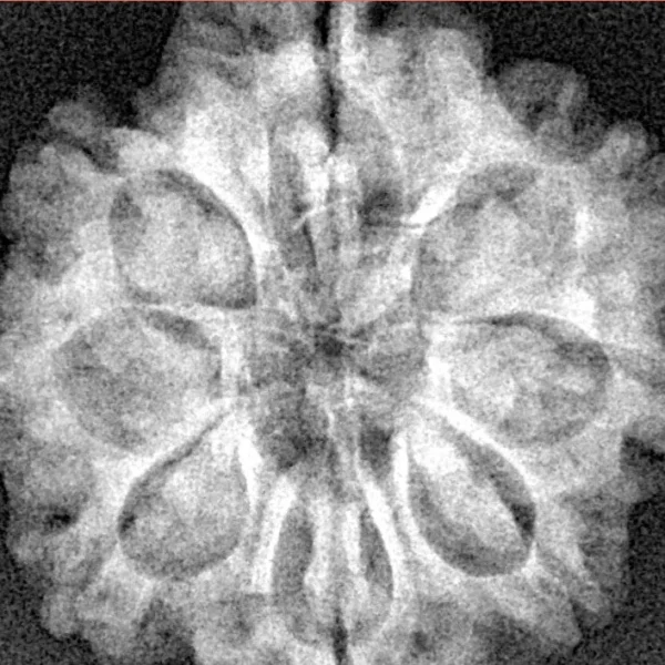 8 Mukhi Rudraksha 25.8mm 5.23gm - Xray