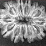 12 Mukhi Rudraksha 29.1mm 4.71gm - Xray
