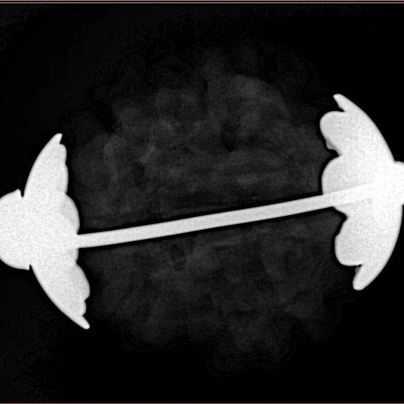 1MK(Underdeveloped) 20.3mm 5gm - Xray