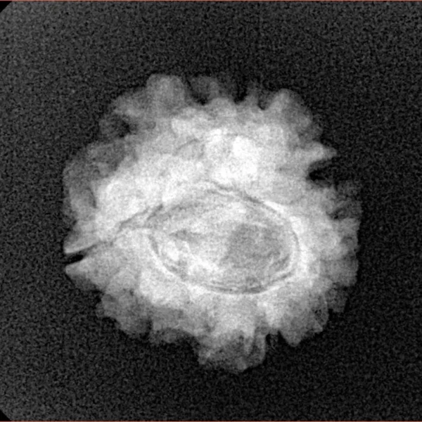 1 Mukhi Rudraksha 21.7mm 2.7gm - Xray