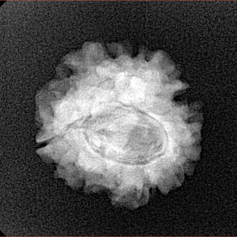 1 Mukhi Rudraksha 21.7mm 2.7gm - Xray