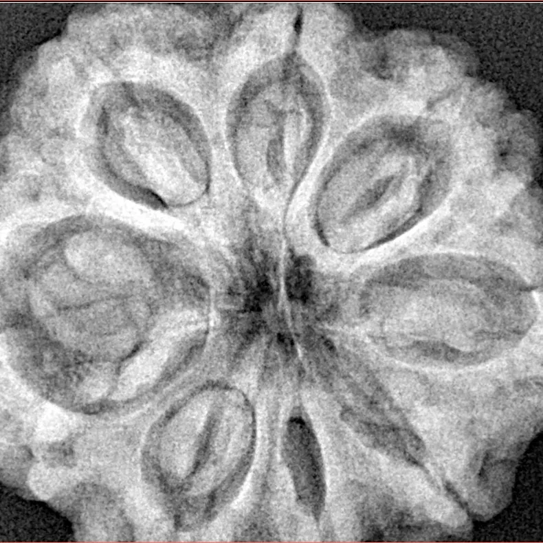 8 Mukhi Rudraksha 32.5mm 8.29gm - Xray