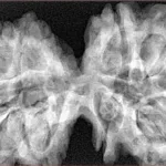 10 Mk Gaurishankar 39.8mm 8.59gm - Xray