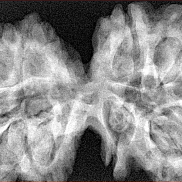10 Mk Gaurishankar 39.8mm 8.59gm - Xray