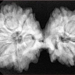 10 Mk Gaurishankar 39.4mm 8.58gm - Xray