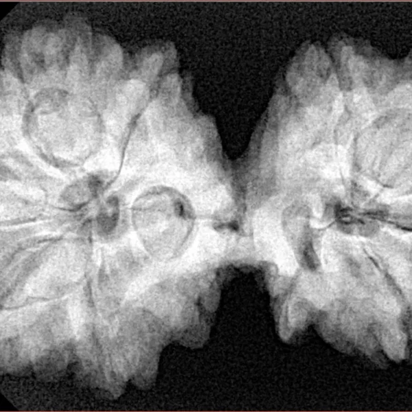 10 Mk Gaurishankar 39.4mm 8.58gm - Xray
