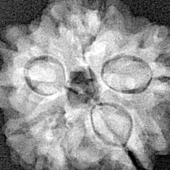 1MK(Underdeveloped) 21.6mm 3.31gm - Xray