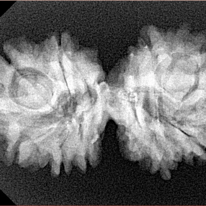 11 Mukhi G.S & Ganesh 32.9mm 4.65gm - Xray