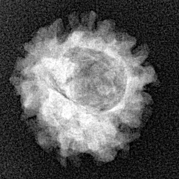 1 Mukhi Rudraksha 19.7mm 1.74gm - Xray