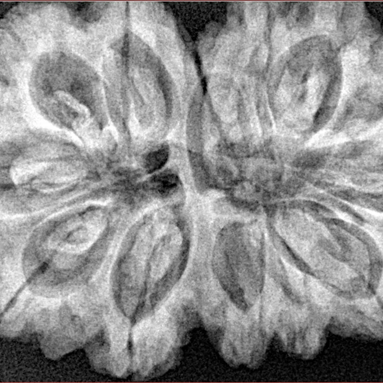 13 MK Gaurishankar 36.2mm 8.38gm - Xray