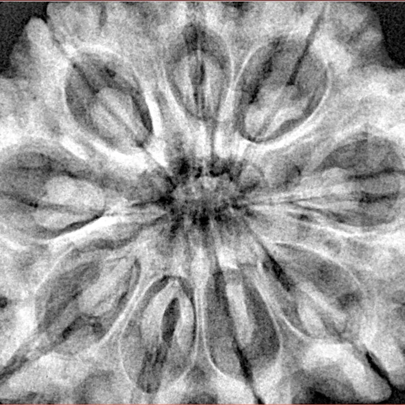 9 Mukhi Rudraksha 34.9mm 9.93gm - Origin: Nepal - Xray