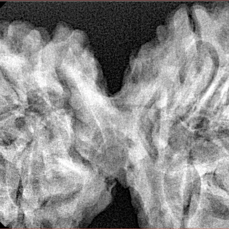 10 Mk Gaurishankar 43.4mm 10.93gm - Xray