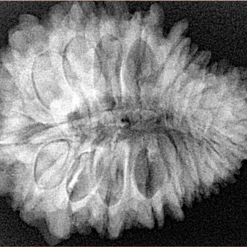 20 Mukhi Rudraksha 29.9mm 5.67gm - Xray
