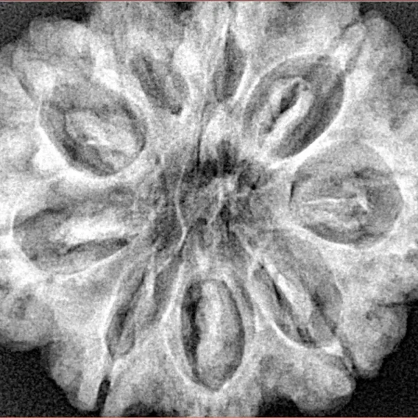 9 Mukhi Rudraksha 30.9mm 7gm - Xray