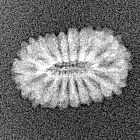 17 Mukhi Rudraksha 13.9mm 0.53gm - Xray