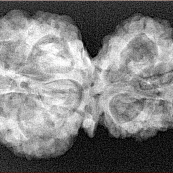 11 Mukhi G.S & Ganesh 33.8mm 5.98gm - Xray
