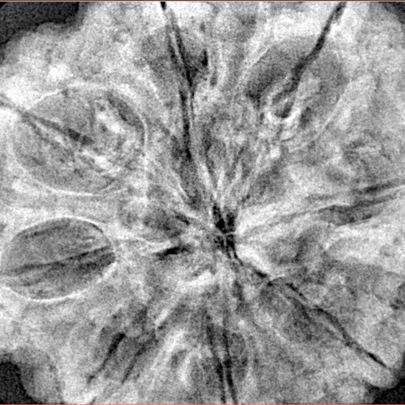 8 Mukhi Rudraksha 34mm 8.72gm - Xray