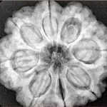 8 Mukhi Rudraksha 28.3mm 7.39gm - Xray