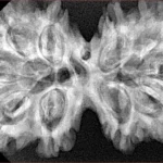 10 Mk Gaurishankar 38.4mm 7.1gm - Xray