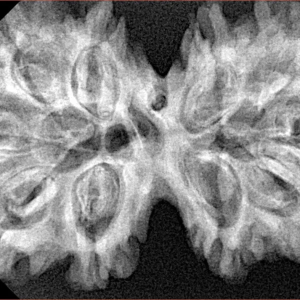 10 Mk Gaurishankar 38.4mm 7.1gm - Xray