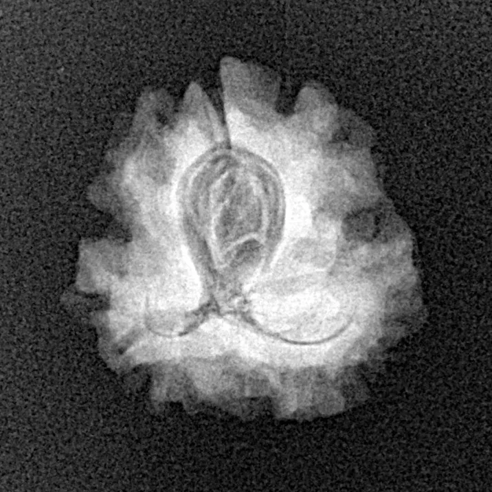 1 Mukhi Rudraksha 20.2mm 2.22gm - Xray