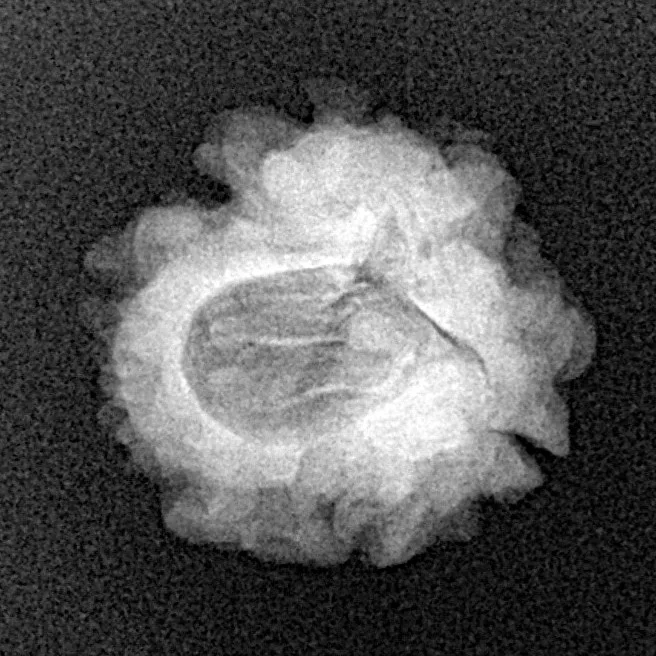 1 Mukhi Rudraksha 20mm 2gm - Xray