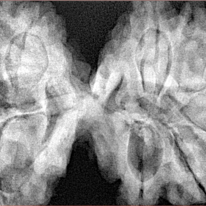 10 Mk Gaurishankar 43mm 11.74gm - Xray
