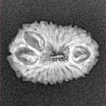 16 Mukhi Rudraksha 18.8mm 1.24gm - Xray