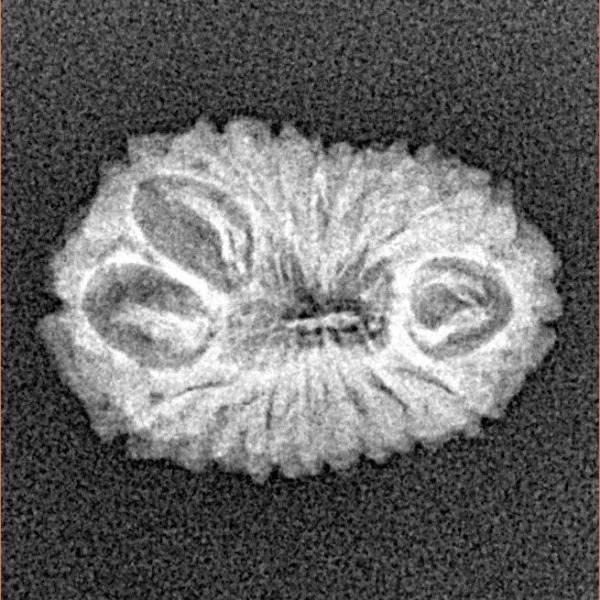 16 Mukhi Rudraksha 18.8mm 1.24gm - Xray
