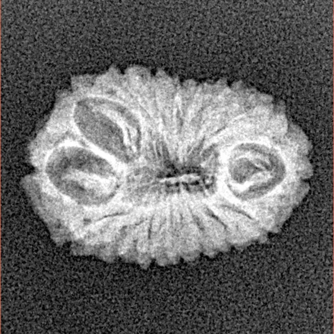 16 Mukhi Rudraksha 18.8mm 1.24gm - Xray