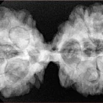 10 Mk Gaurishankar 40.1mm 8.78gm - Xray