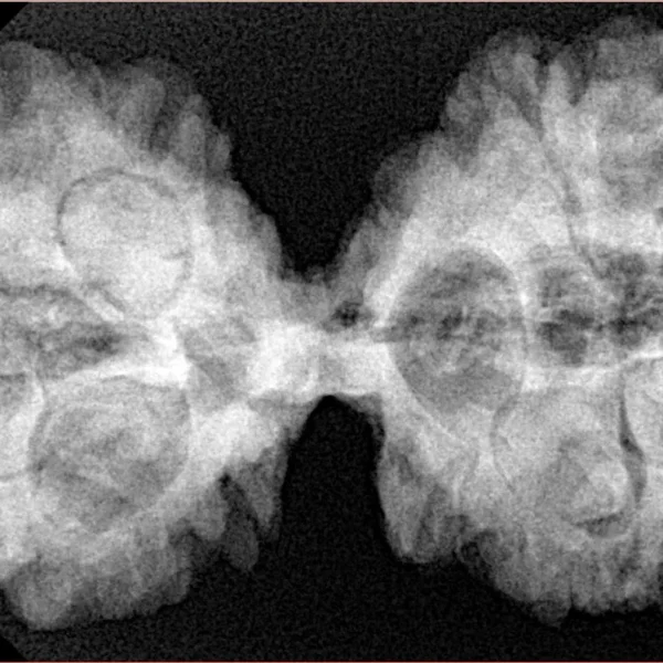 10 Mk Gaurishankar 40.1mm 8.78gm - Xray