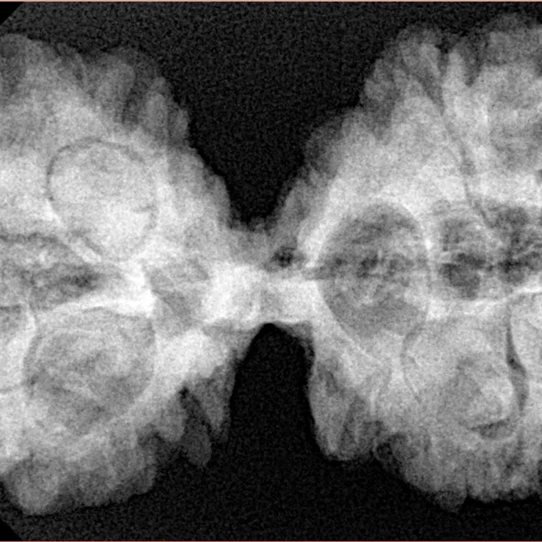 10 Mk Gaurishankar 40.1mm 8.78gm - Xray