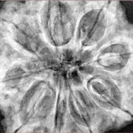 9 Mukhi Rudraksha 33.5mm 9.42gm - Xray